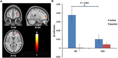 Decreased modulation by the risk level on the brain activation during decision making in adolescents with internet gaming disorder